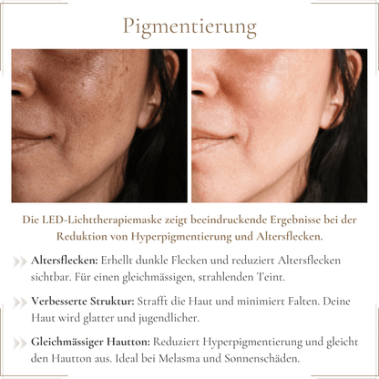 LED Beauty Maske mit 7 Farben – Anti-Aging und Aknebehandlung